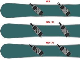 單闆固定器的角度選擇