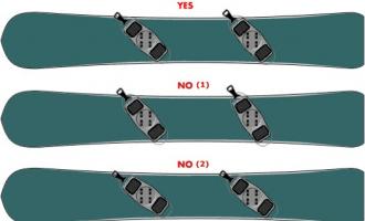 單闆固定器的角度選擇